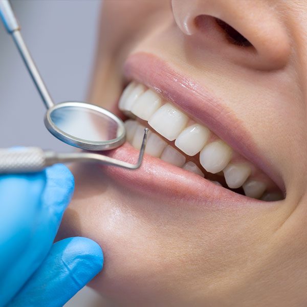 cpd-dental-cleaning-2